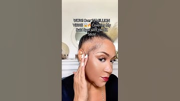 WOW! Over 1.5 MILLION VIEWS 😱🔥 Covering My Bald Spot with the EZ Stick!