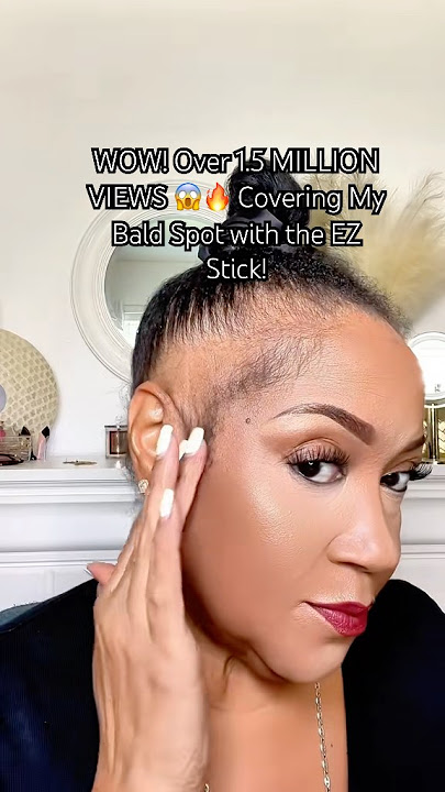WOW! Over 1.5 MILLION VIEWS 😱🔥 Covering My Bald Spot with the EZ Stick!