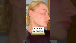 Заказать Псорифенак можно на Wildberries. Артикул - 430728516