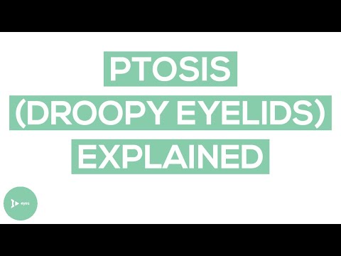 Droopy Eyelids | Eyelid Ptosis Causes and Symptoms | IntroWellness
