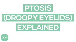 Droopy Eyelids | Eyelid Ptosis Causes and Symptoms