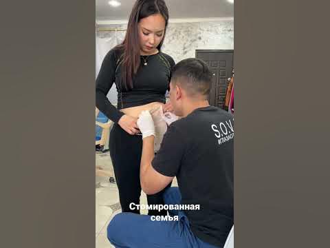 Колостома colostomia калоприемник - YouTube