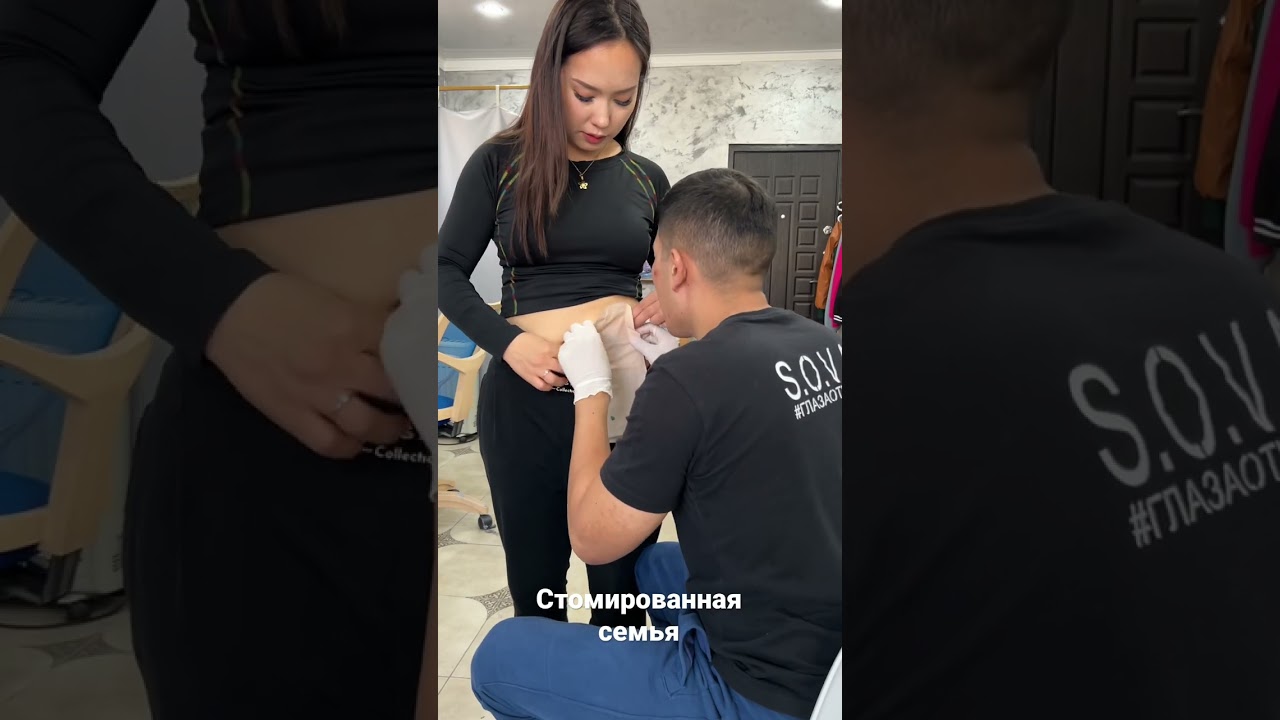 Колостома colostomia калоприемник