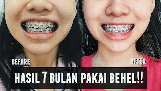 PENGALAMAN BEHEL | Harga, Proses dan Hasilnya