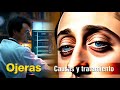 Por qué salen ojeras y bolsas en los ojos - causas y tratamientos