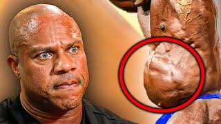 Phil Heath About His BUBBLE GUT Problem