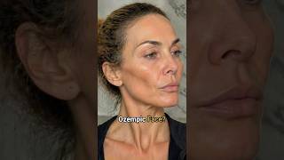 Was ist dran an Ozempic Face? | Dr. med. Hendrik Schuster