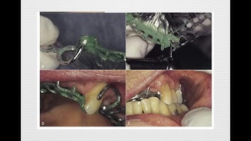 10. RPD framework try in