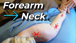 Forearm Tension Led to Her Neck Tension - Back and Arms Deep Tissue Massage