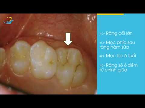 Video QUÁ TRÌNH MỌC RĂNG CỦA TRẺ EM - youtube