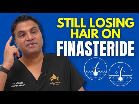 Still Losing Hair Even When On Finasteride