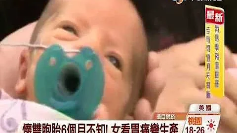【中視新聞】懷雙胞胎6個月不知! 女子看胃痛變生產 20141015 - 天天要聞