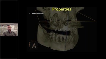 Improve Ridge Augmentation and Immediate Implant Techniques Utilizing laminar bone and allografts