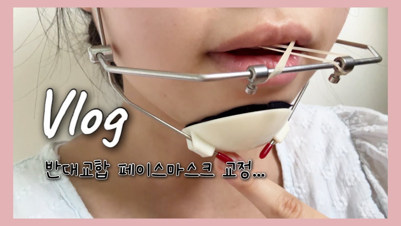 [Vlog] 페이스마스크 교정 / 반대교합 교정 / 초밥 / 가츠동 /치아교정 🦷❤️🥰