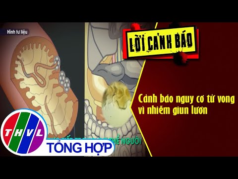 Bệnh Giun Lươn Ở Người - Cảnh báo nguy cơ tử vong vì nhiễm giun lươn