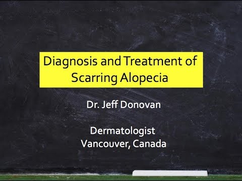 Diagnosis & Treatment Scarring Alopecia 2018