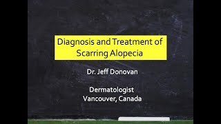 Diagnosis & Treatment Scarring Alopecia
