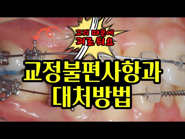 교정불편사항과 대처방법! (교정기에 달린 고리)