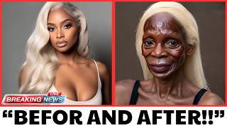 25 Black Celebrities Who RUINED Their Careers With PLASTIC SURGERY