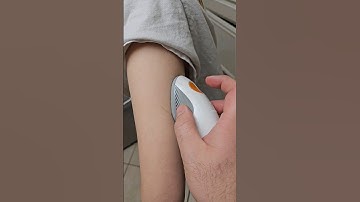 Eerste Dexcom-verandering van het jaar #diabetes #t1d #typeonediabetes #dexcom #dexcomg6 #express...