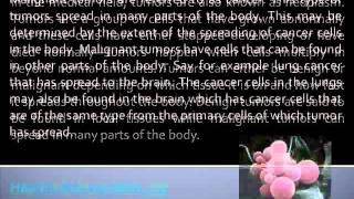 What Benign and Malignant Tumors Are