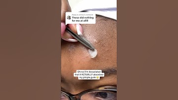 Are these pimple patches too good to be true??