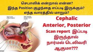 cephalic position of baby in tamil | different positions of baby during pregnancy  in tamil