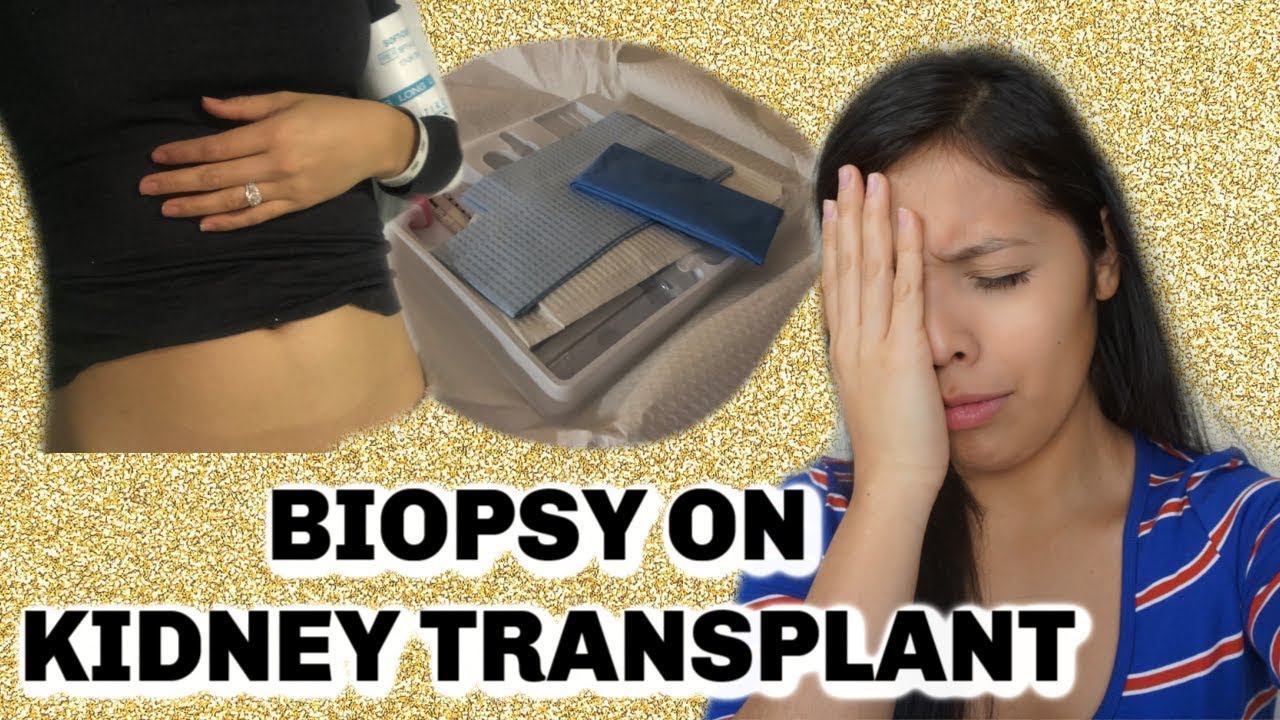 WHAT DOES A KIDNEY TRANSPLANT BIOPSY CONSIST OF! KIDNEY BIOPSY! 2 YEAR POST KIDNEY TRANSPLANT