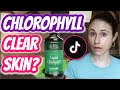 CHLOROPHYLL WATER FOR CLEAR SKIN: Tiktok skin care FAIL| Dr Dray