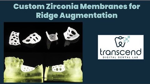 FB Live Tutorial on Designing Custom Zirconia Membranes for Ridge Augmentation