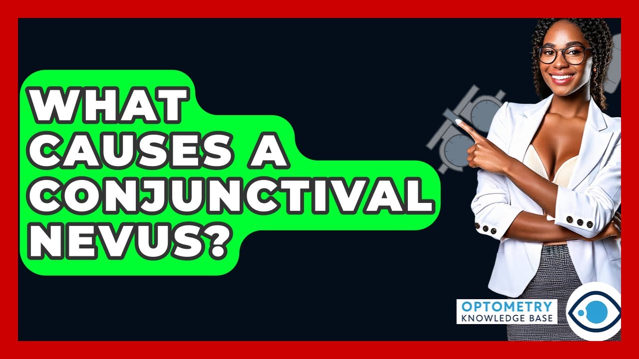 What Causes A Conjunctival Nevus? - Optometry Knowledge Base