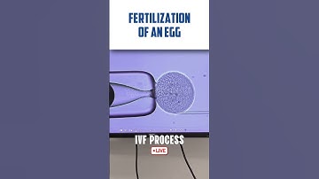 IVF transfer procedure LIVE VIDEO 🔴 Fertilization of Egg & Sperm in Human #fertilization #ivfprocess