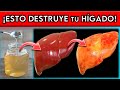 ¡ALIMENTO Nº1 más DAÑINO para el HÍGADO! || ¡Causan HÍGADO GRASO!