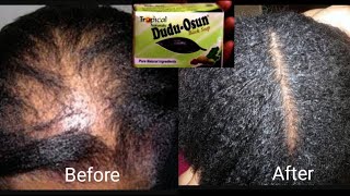 Dudu Osun Soap | Secret To Hair Growth & Volume | Alternative To 'Neutralizing' Shampoo!
