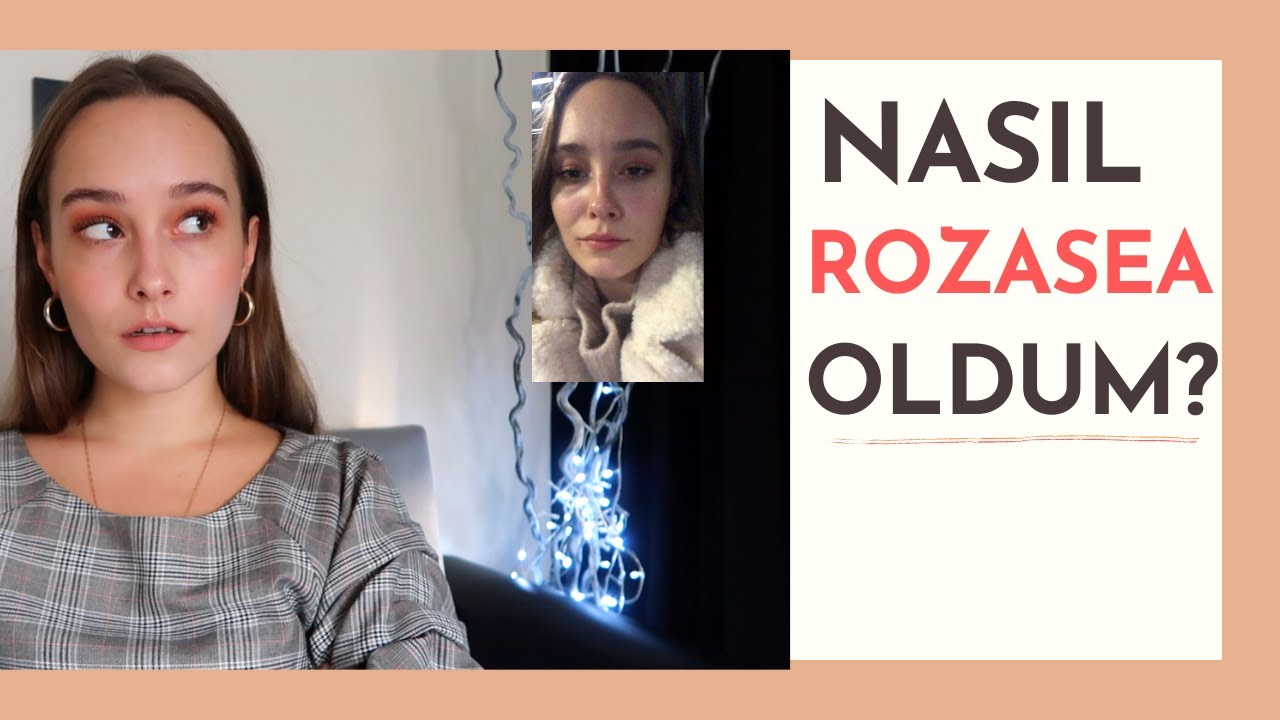ROZASEA NEDİR? - BENİM BAŞIMA NASIL GELDİ? #ROZASEADOSYASI 1