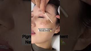 चहर क कल दग धबब क कस ठक कर Get Fair & Clear Skin