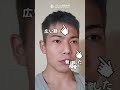 ビフォーアフター┃輪郭+鼻+額┃アイドルを目指した彼の大変身✨️┃ブラウン整形外科┃#韓国 #美容 #男性向け #男性美容 #垢抜け #額縮小 #輪郭3点 #渡韓