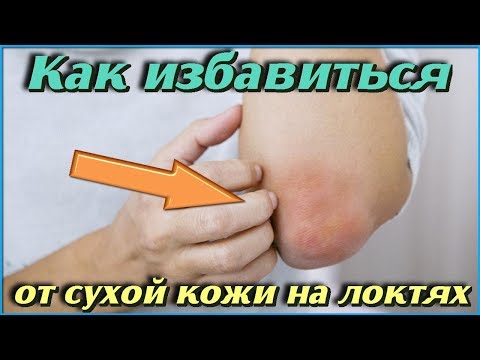 Что делать если СУХАЯ КОЖА НА ЛОКТЯХ Полезные советы по уходу за локтями Женские СЕКРЕТЫ КРАСОТЫ