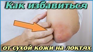 Что Делать Если Сухая Кожа На Локтях Полезные Советы По Уходу За Локтями Женские Секреты Красоты