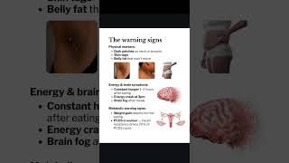 Be Healthy ✅💪🏿#food #trendingshorts #trending #tips SUBSCRIBE FOR MORE.