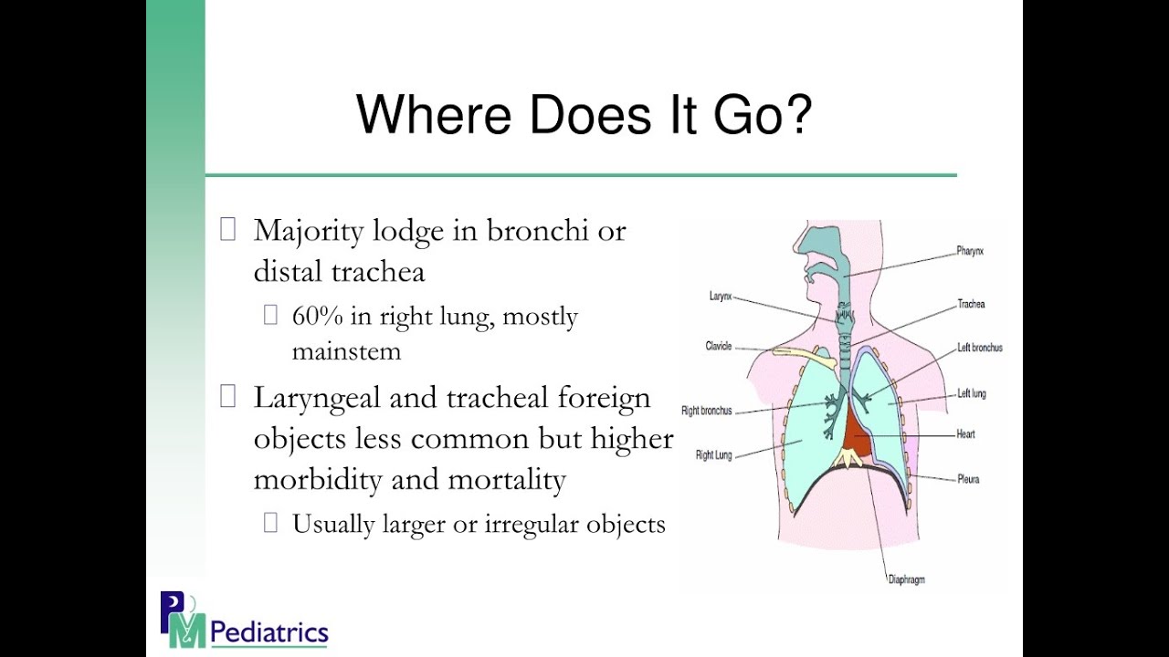 Why inhaled foreign bodies will likely Enter the Right lung and not the