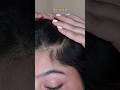 #hairthinning #hairthinningsolution #haircare #haircareroutine #haircareproducts #hairserum #fyp