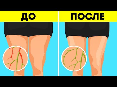 6 простых упражнений для похудения без диет