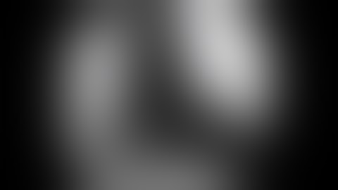 INFINITY™ Total Ankle System featuring PROPHECY™ Preoperative Navigation