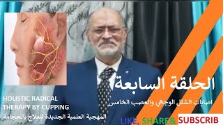 اصابات الشلل الوجهي والعصب الخامس والاصابات البصرية للمسار الكهفي العلاجي الجزء الثاني