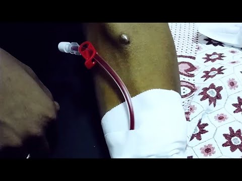 تعليم الغسيل الكلوي الجزء الأول تركيب الوصلات     