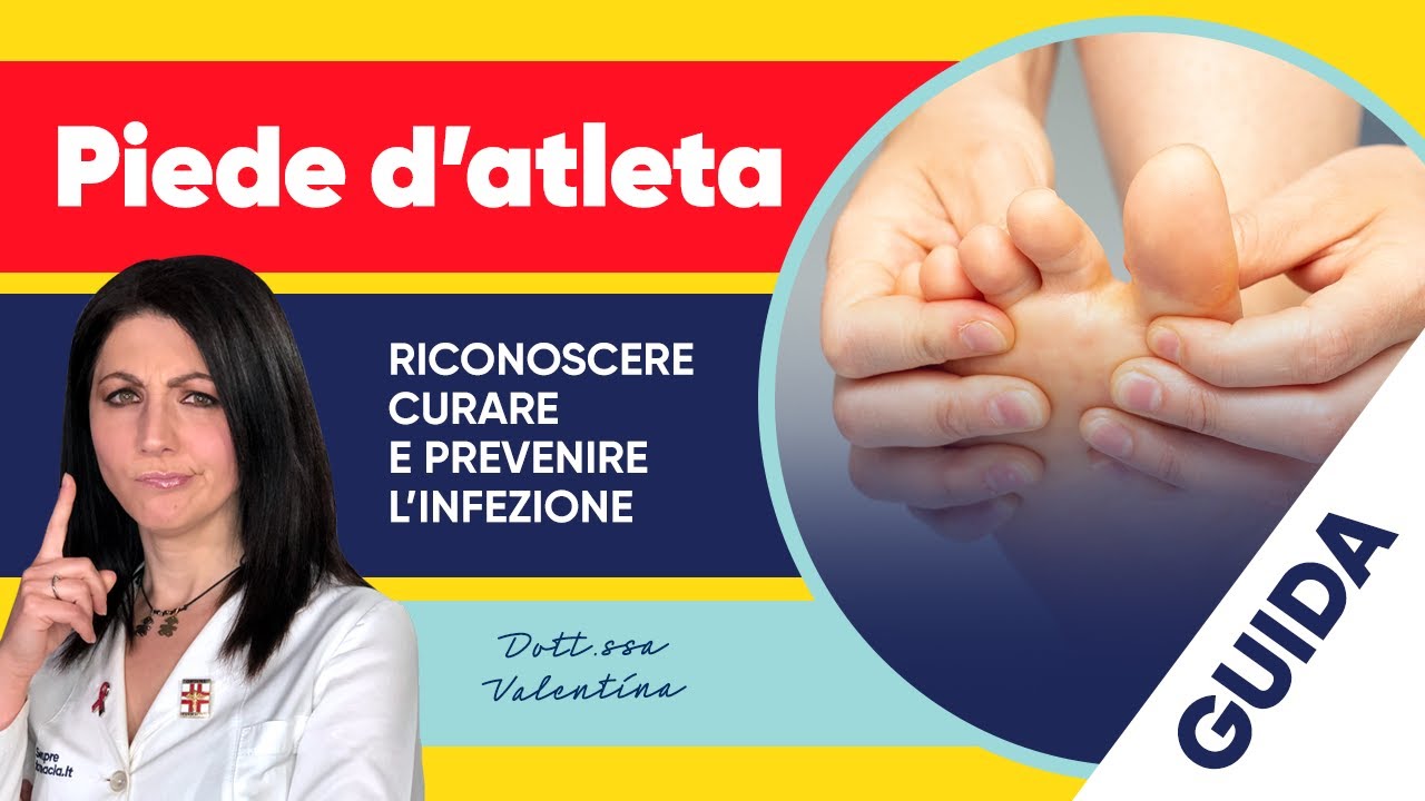 Piede d'atleta: come riconoscere, curare e prevenire l'infezione 