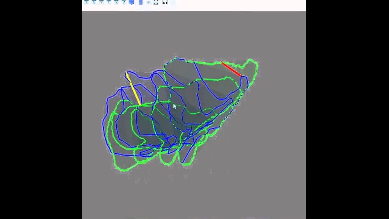 Hausdorff distance in 3D based on DICOM RTStruct file - YouTube