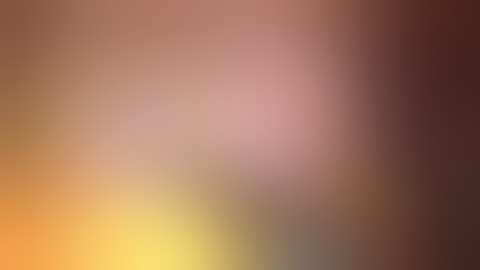 Lap sigmoid colectomy