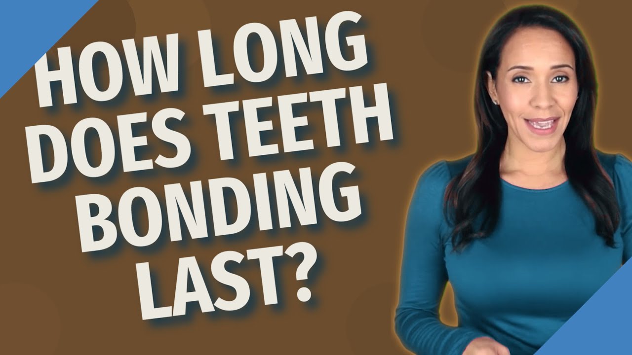 How long does teeth bonding last? YouTube
